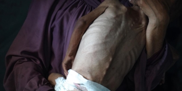 gazze-aclik-a-2387825