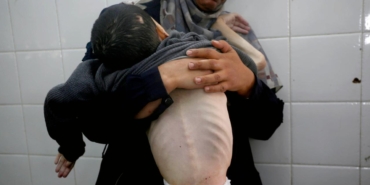 gazze-aclik-aa-2386387-1