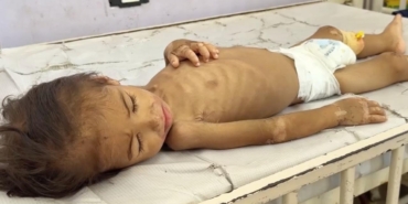 gazze-aclik-aa-2397391-1