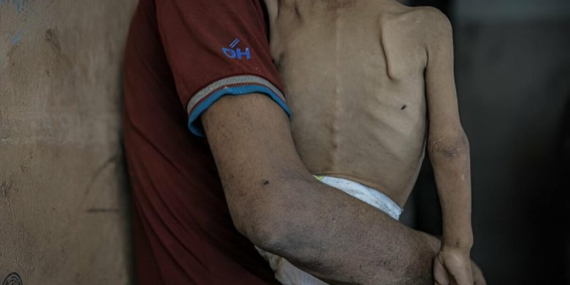 gazze-aclik-cocuk-2381463