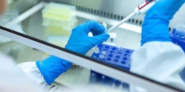 hepatit-laboratuvar-2085096