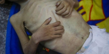 gazze-aclik-aa-2381767