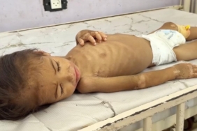 gazze-aclik-aa-2397391