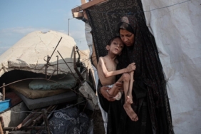 gazze-yetersiz-beslenme-aa-2402770