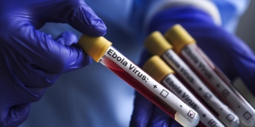 ebola-virus-aa-2463951-1