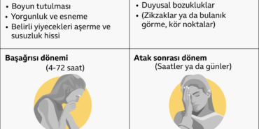 kadinlar-neden-erkeklerden-daha-fazla-migren-2-20232613_amp
