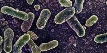 salmonella-hastaligi-nedir-ne-demek-1810078
