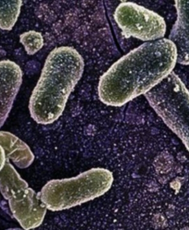 salmonella-hastaligi-nedir-ne-demek-1810078